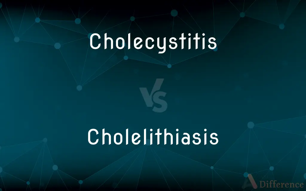 Cholecystitis vs. Cholelithiasis — What's the Difference?