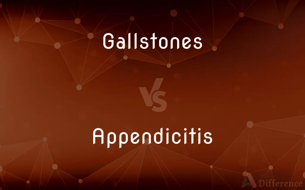 Gallstones vs. Appendicitis — What's the Difference?